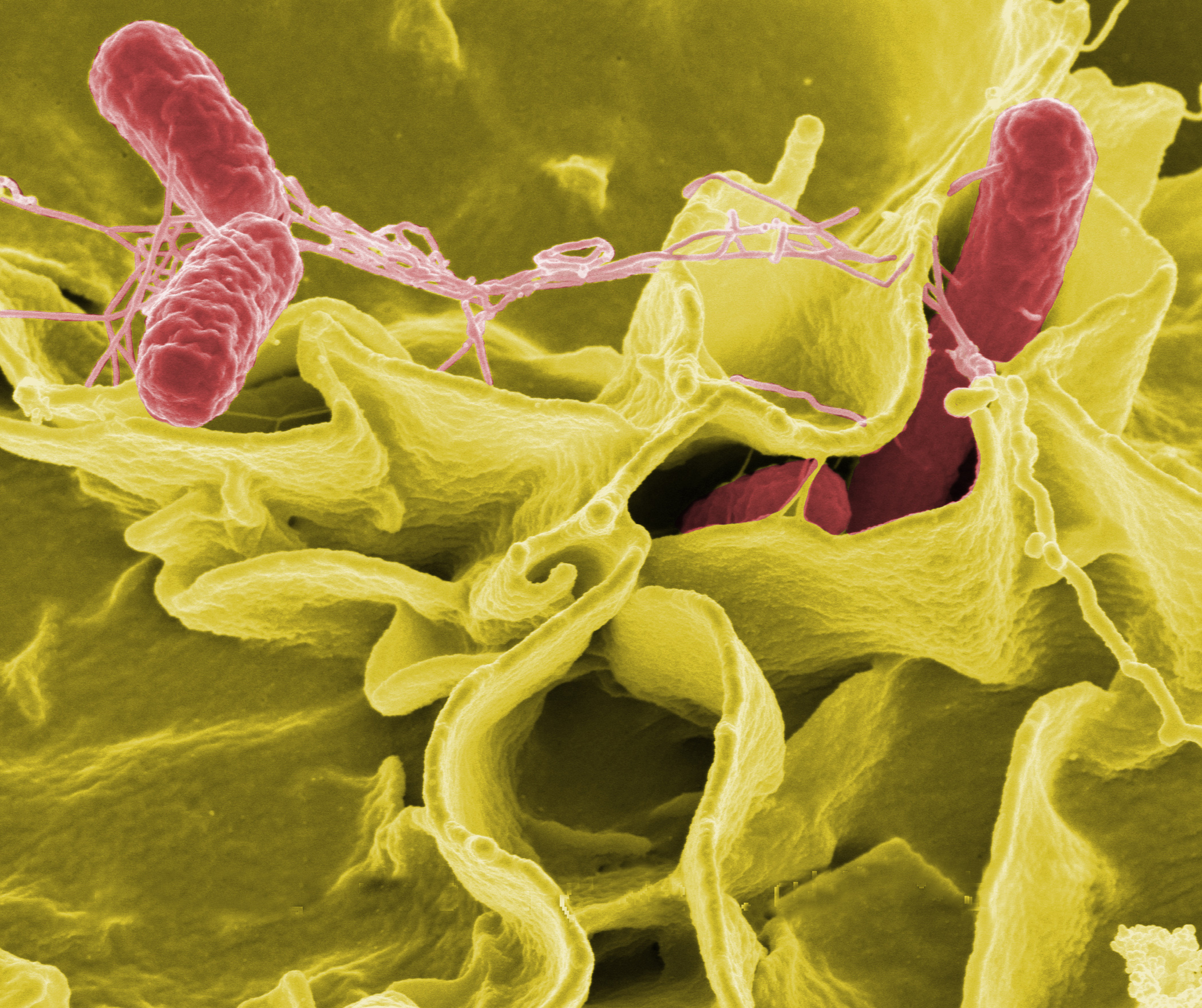 La résistance aux antibiotiques se généralise. Par exemple, 80 % des souches responsables de la gonorrhée sont insensibles à la tétracycline, un traitement de première ligne. Même les médicaments les plus puissants, comme les carbapénèmes, commencent à montrer des signes de faiblesse. Au Royaume-Uni en 2003, on a noté trois cas de bactéries tolérantes à ces composés. Ici au microscope des Salmonella typhimurium, en rouge, sur une culture de cellules humaines. © DP