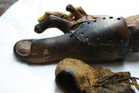 La prothèse du musée du Caire (Crédit : Jacky Finch).
