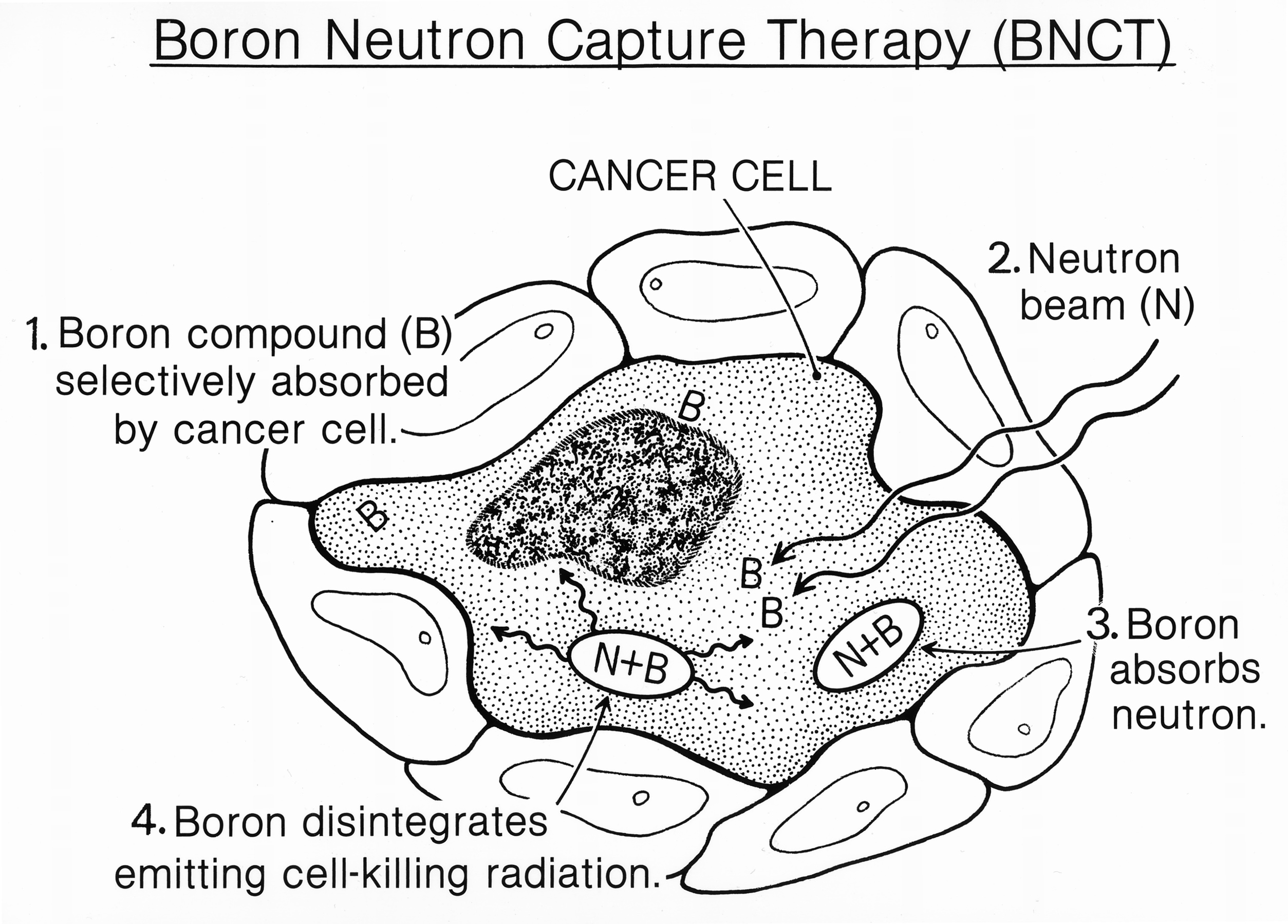 La Boron Neutron Capture Therapy (BNCT) est une méthode d’irradiation en plusieurs étapes : (1) le bore 10 est absorbé par la cellule cancéreuse, (2) le neutron entre à son tour dans la cellule, (3) le bore interagit avec le neutron pour donner du bore 11, (4) le bore 11 se désintègre et émet des radiations qui tuent la cellule. © National Cancer Institut, Wikimedia Commons, cc by sa 3.0