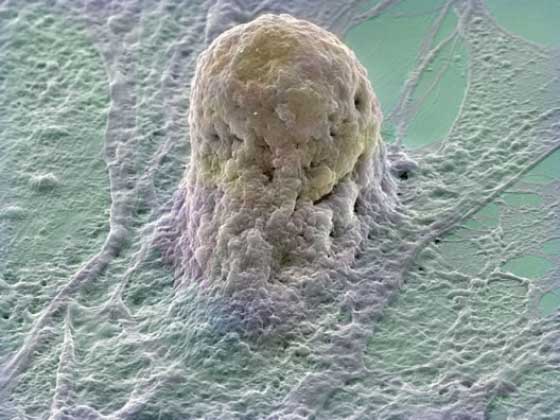 Cellule souche embryonnaire humaine se développant sur une couche de fibroblastes. Crédit : DR