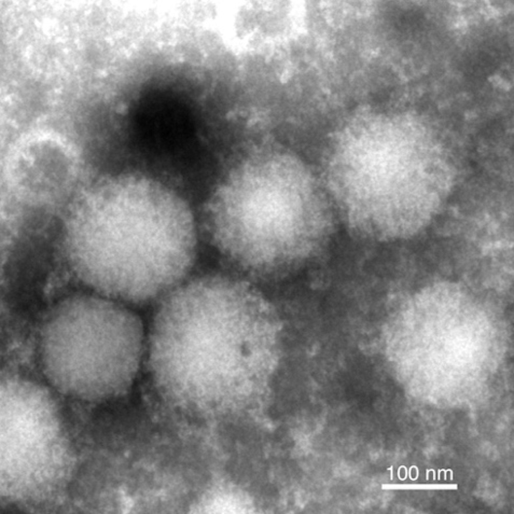 Le virus Yezo est le premier orthonairovirus connu à infecter l’Homme. © Fumihiro Kodama, et al., Nature Communications, 2021