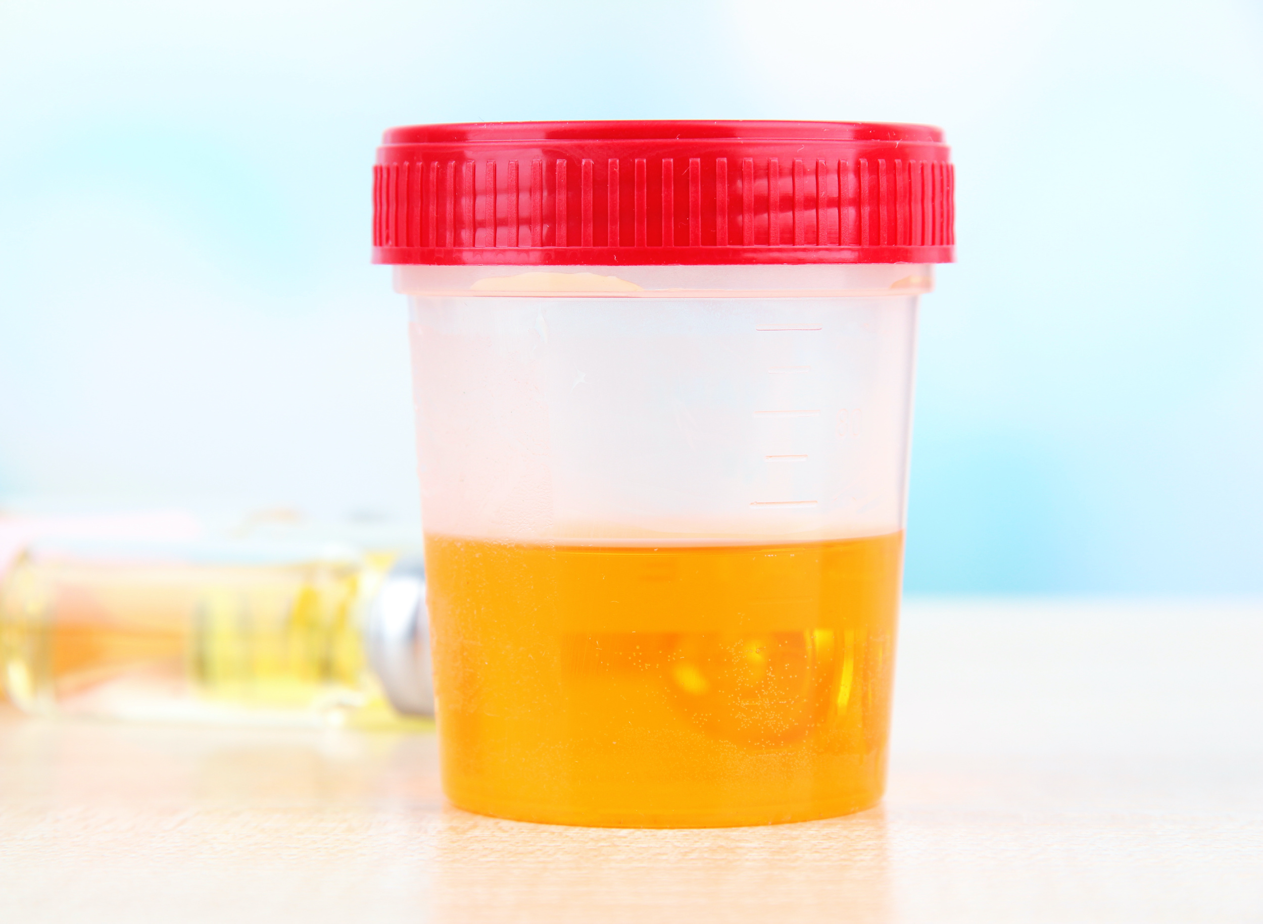 Le syndrome d’auto-fermentation urinaire est lié au développement de levures dans la vessie. © Africa Studio, Adobe Stock