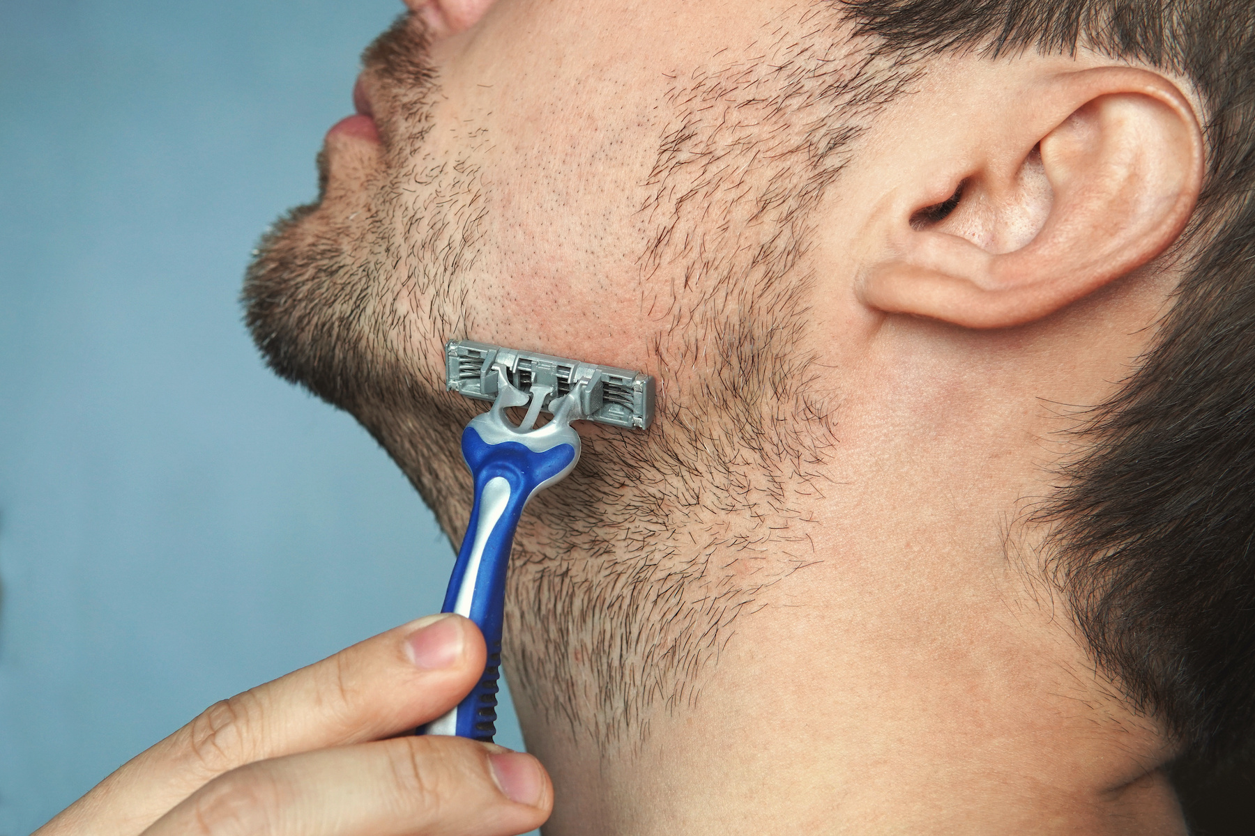 Les poils incarnés sont fréquents après un rasage de la barbe. © diy13, Adobe Stock