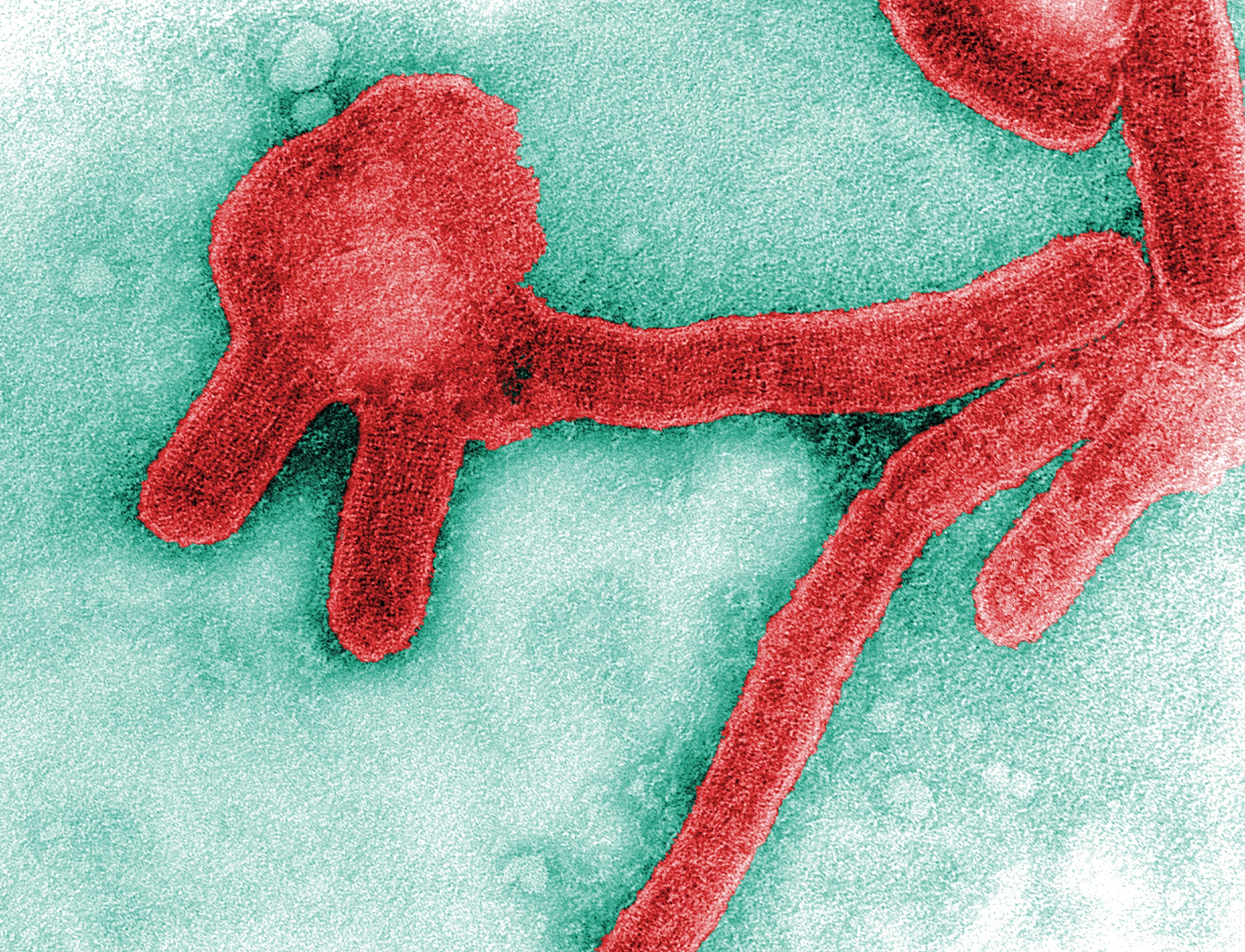 Le virus de Marburg appartient à la même famille que celui d’Ebola. © CDC, Frederick Murphy
