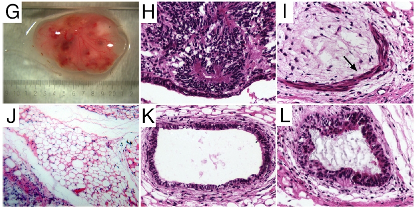 Les cellules IPS obtenues à partir de cellules adipeuses humaines ont été différenciées en plusieurs types cellulaires. Une fois implantées chez des souris, elles ont formé un tératome (G) comprenant les trois familles de tissus de l'embryon (les feuillets) : l'ectoderme, le mésoderme et l'endoderme. On reconnaît du tissu nerveux (ectoderme, photo H), du muscle lisse (mésoderme, image I, marqué par une flèche) et du tissu adipeux (mésoderme, en J) et deux tissus de l'endoderme, en l'occurrence de l'épithélium du tube digestif (K) et du système respiratoire (L). © Ning Sun et al., Pnas