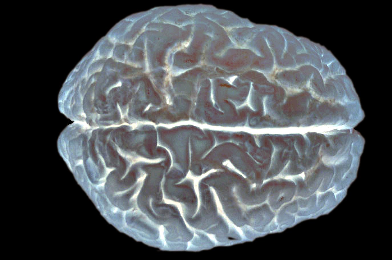 Le cerveau cache encore de nombreux mystères. Dans cette étude, les chercheurs ont découvert un gène impliqué dans les facultés intellectuelles, qui affecterait le développement du cortex. © EUSKALANATO / Flickr - Licence Creative Commons (by-nc-sa 2.0)