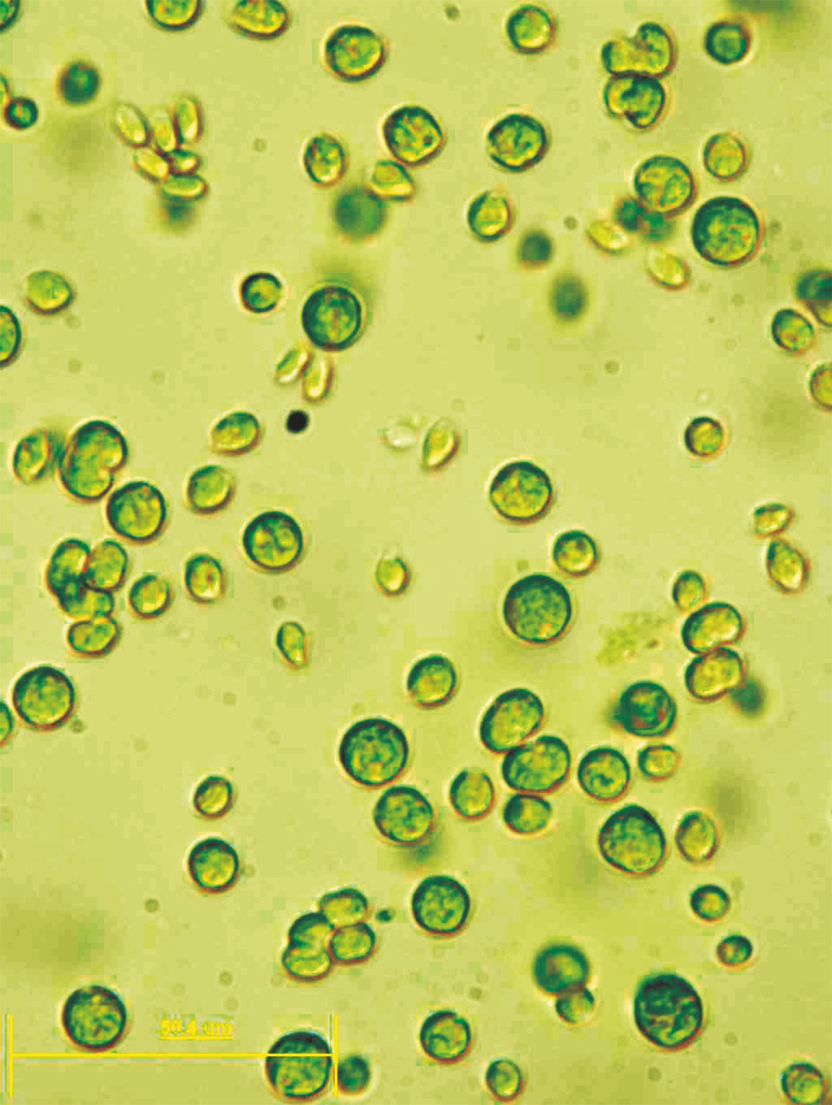 Chlamydomonas reinhardtii est une algue mobile se déplaçant à l'aide de 2 flagelles. Elle pratique la photosynthèse, ce qui ne l'empêche pas de partager certaines caractéristiques génomiques avec les animaux (environ 10 % de ses gènes). Cet organisme est utilisé comme modèle biologique depuis les années 1960.&nbsp;© université de Bielefeld