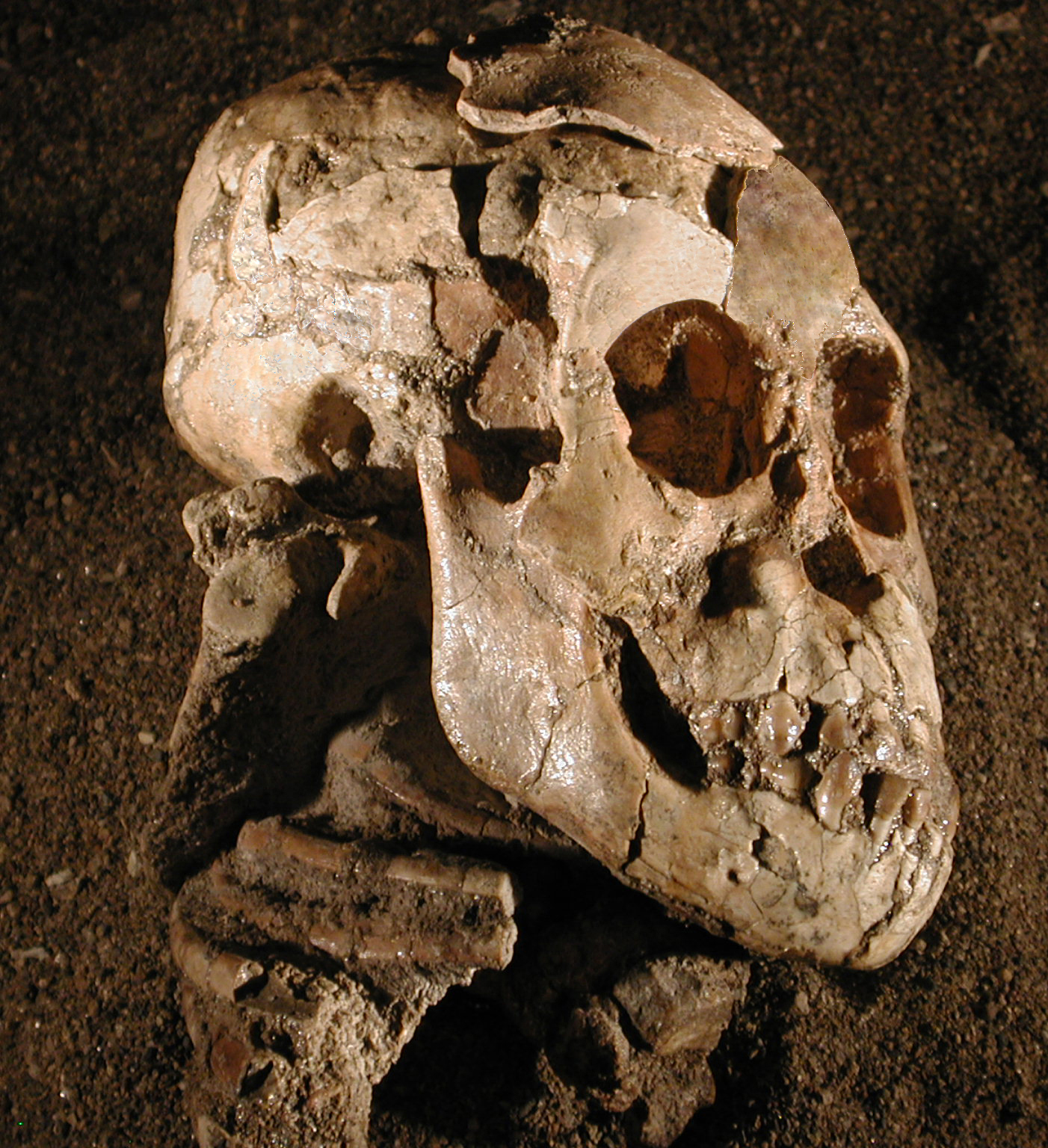 Vue latérale du crâne, de la face et de la mandibule de Selam, un Australopithecus afarensis de 3 ans ayant vécu voici 3,3 millions d’années. L’omoplate droite complète est visible, avec sa cavité glénoïde, son acromion et son processus coracoïde, sous l’arrière du crâne, à gauche de la mâchoire&nbsp;et au-dessus des côtes. © Zeray Alemseged, Dikika Research Project