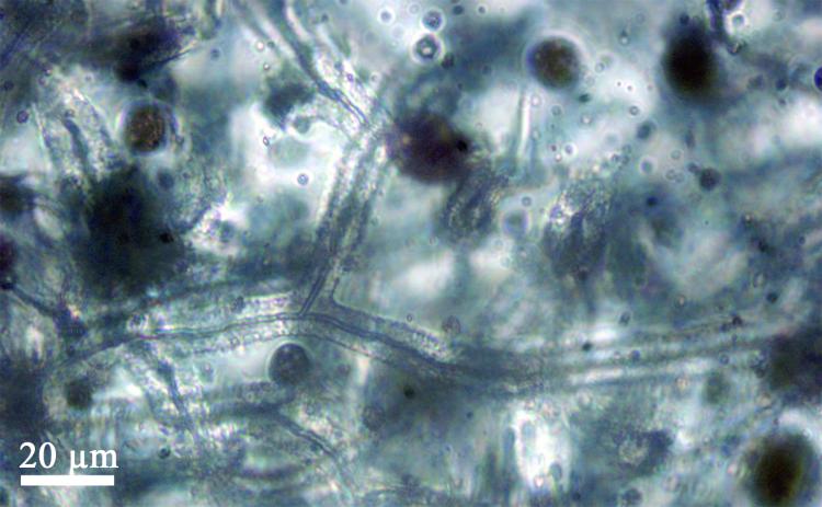 Enfermées dans la résine depuis 100 millions d'années, ces cyanobactéries peuvent être observées comme un échantillon fraîchement prélevé. © CNRS-INSU, Rennes I