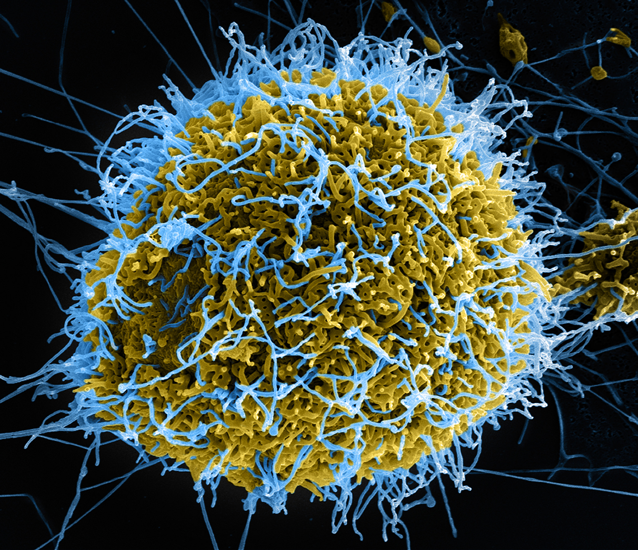 Interview 4/5 : comprendre le virus Ébola