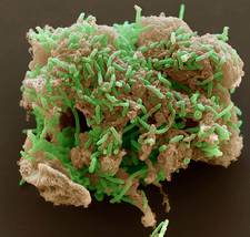 Geobacter est un genre bactérien souvent&nbsp;utilisé en bioremédiation (pour réaliser de la contamination). Sur cette image en microscopie, un groupe de bactéries Geobacter se développe sur un morceau d'oxyde de fer.&nbsp;© Derek Lovley