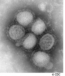 Des particules du virus H1N1 vues au microscope électronique. © Centers for Disease Control and Prevention
