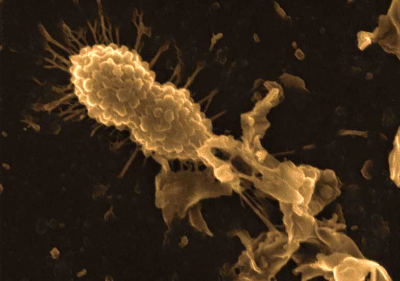 Une bactérie (en haut à gauche) s’approche d'une autre venant d'être détruite par un complexe Hamlet-antibiotique. L’Hamlet agit en induisant une dépolarisation de la membrane plasmique. © Laura R. Marks et al, Plos One