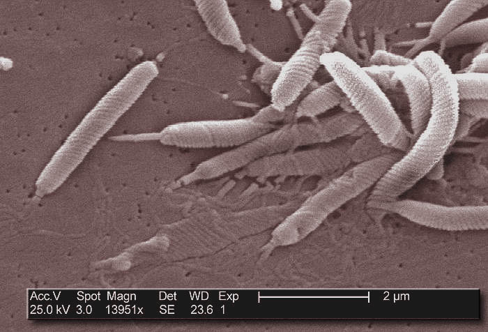 Des bactéries Helicobacter pylori vues en microscopie électronique. Le nom de cette bactérie vient de sa structure externe hélicoïdale.&nbsp;© Janice Carr, CDC, Wikimedia Commons, cc by sa 3.0