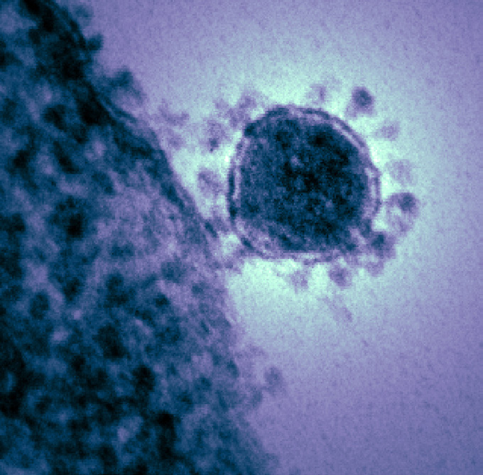 Le coronavirus MERS-CoV frappe principalement les populations vivant ou venant du Moyen-Orient, l'Arabie Saoudite en tête. C'est là que l'on trouve les sources de l'épidémie, même si celles-ci ne sont pas encore vraiment identifiées.&nbsp;© NIAID