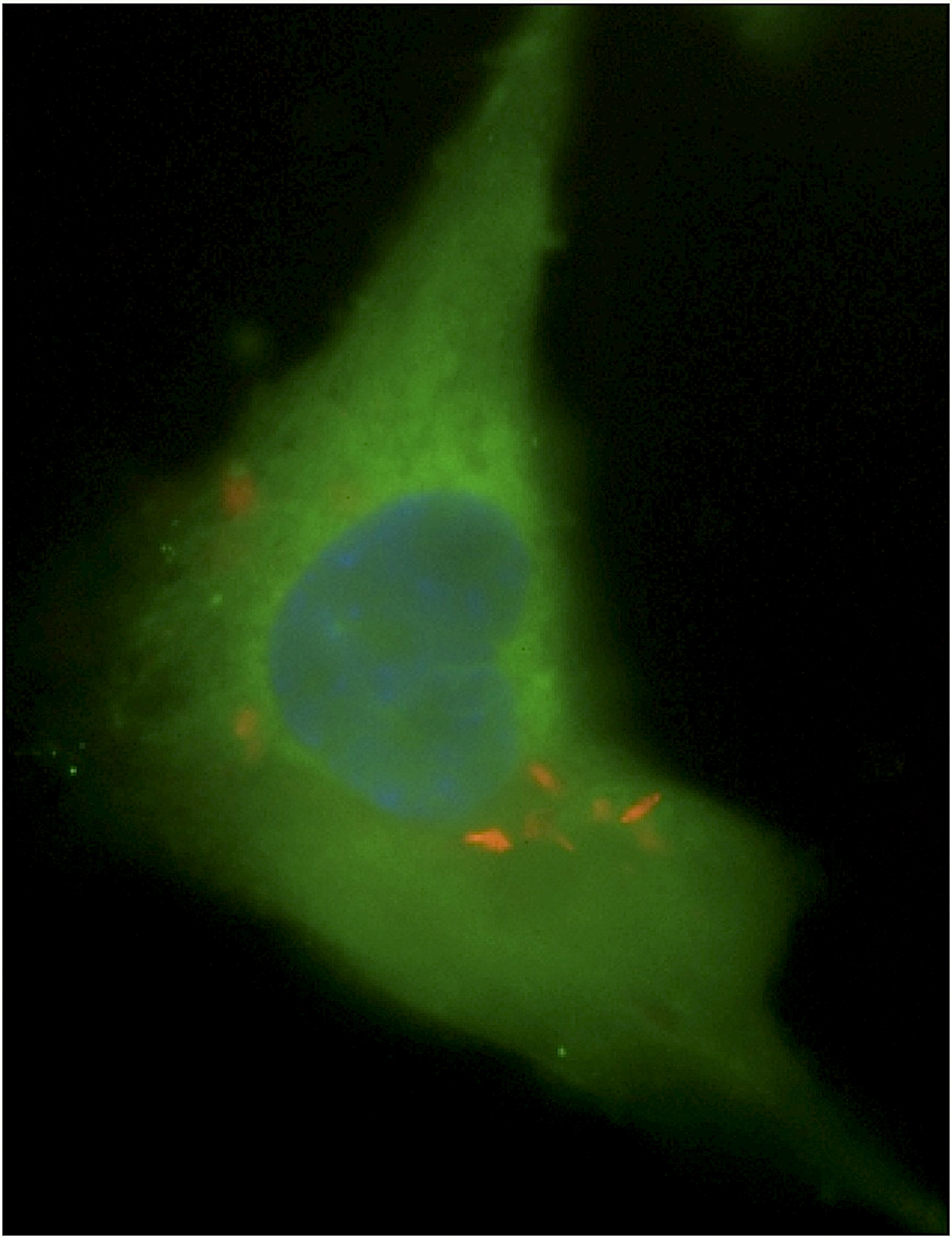 Image d'une cellule souche osseuse (en vert) infectée par des bactéries Mycobacterium tuberculosis&nbsp;(en orange). Celles-ci peuvent y résider à l’abri du système immunitaire. © Bikul Das et al., Science Transitional Medecine, 2013