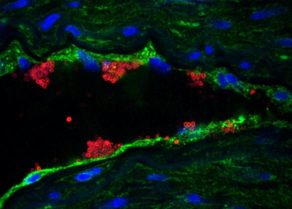 Analyse en immunofluorescence d’une coupe de cerveau humain infecté par le méningocoque, Neisseria meningitidis. Les bactéries (en rouge) ont colonisé les cellules endothéliales cérébrales sur lesquelles sont présents les récepteurs CD147 (en vert). Les marques bleues sont les noyaux cellulaires. © Nature Medicine