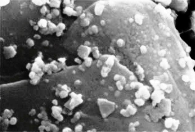 Une vue au microscope électronique d'une population de Metallosphaera sedula. Ces archées tirent leur énergie de l'oxyde&nbsp;d'uranium. ©Yukari Maezato, Paul Blum, University of Nebraska-Lincoln