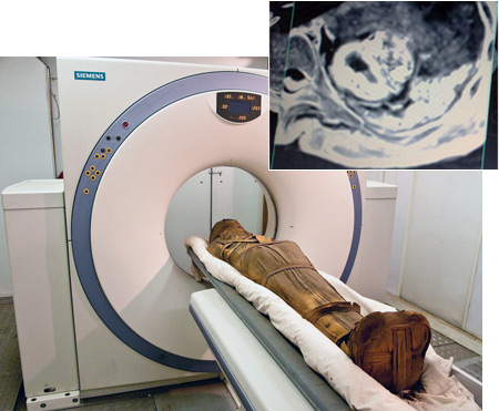 Une momie égyptienne entre dans un CT-scan. En médaillon, un cœur (rarissime sur une momie) dans lequel les chercheurs repèrent des calcifications, traces de la présence d'athéromes du vivant de cette personne. © Egyptian Antiquities Commission
