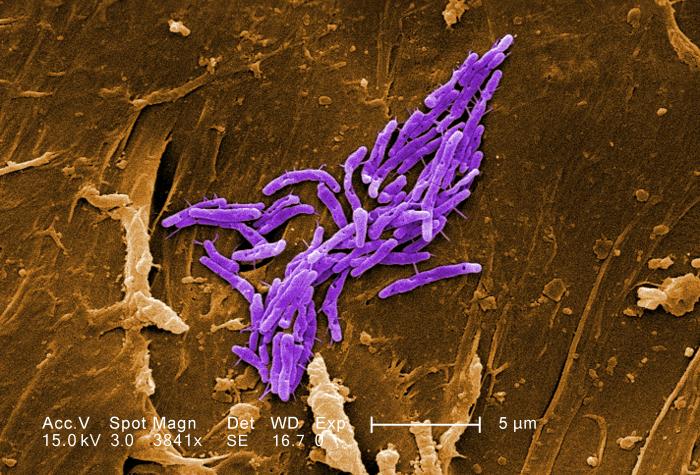 Mycobacterium tuberculosis, représentée par&nbsp;ces bâtonnets colorisés en violet, est la bactérie responsable de la tuberculose. On l'appelle aussi bacille de Koch, en référence à son découvreur. Selon l'OMS, en 2010, près de 9&nbsp;millions de cas ont été détectés à travers&nbsp;le monde et 1,4 million de personnes&nbsp;en sont mortes. La maladie&nbsp;n'est donc pas anodine.&nbsp;© Janice Haney Carr, CDC, DP