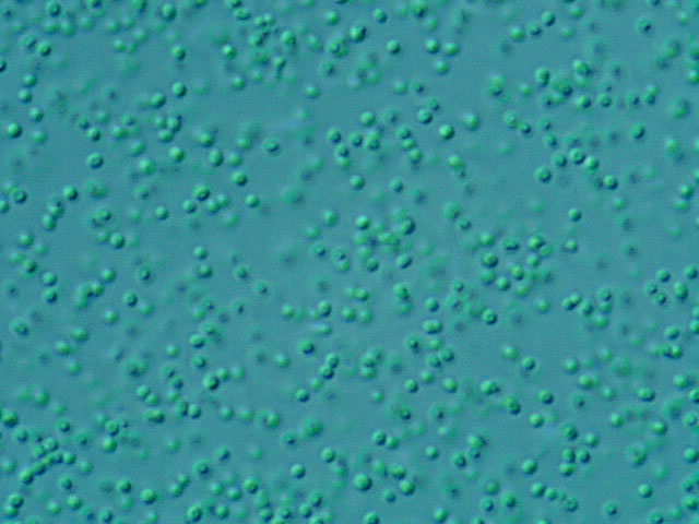 Ces cyanobactéries Prochlorococcus marinus sont extrêmement abondantes dans les régions tropicales et tempérées chaudes de l'océan ouvert. Certains scientifiques affirment qu'il est l'organisme le plus abondant sur Terre. Il serait responsable de près de 50 % de la fixation du carbone dans les océans. © Bob Andersen, D. J. Patterson