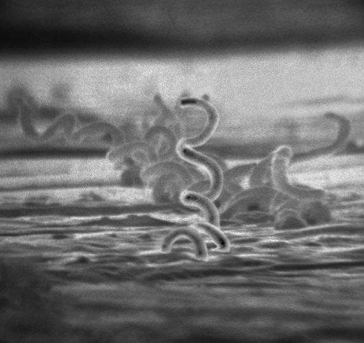 Le tréponème pâle, alias Treponema pallidum, une bactérie responsable de la syphilis. Présente chez une femme enceinte, elle peut traverser le placenta et infecter le fœtus. On parle alors de syphilis congénitale. © Licence commons