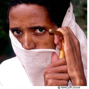 La tuberculose frappe surtout l'Asie et l'Afrique. © WHO / Pierre Virot