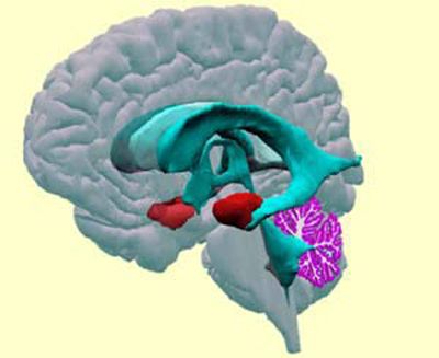 Amygdale (en rouge). Source: University of Washington Digital Anatomist Program.