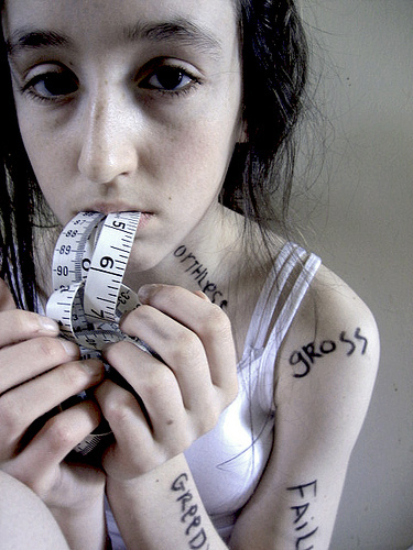 L'anorexie est une maladie qui frappe souvent des adolescentes, avec des conséquences parfois dramatiques.&nbsp;© habacuc_1988, Flickr, cc by nc sa 2.0