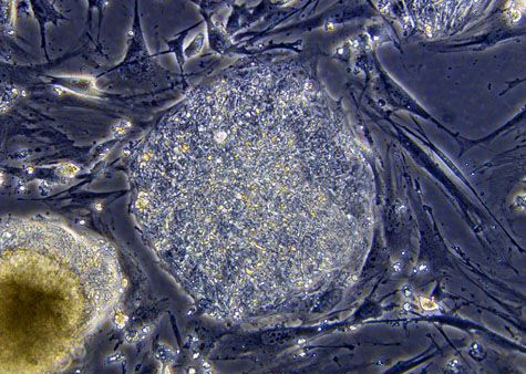Cellules souches embryonnaires.