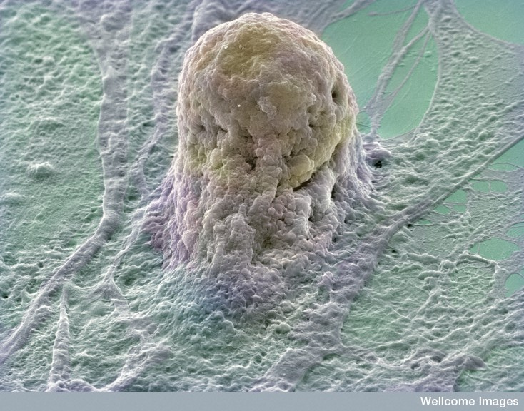 Les cellules souches embryonnaires humaines créées par clonage pourraient intégrer des protocoles de thérapie cellulaire si elles s'avèrent sans danger.&nbsp;© Annie Cavanagh, Wellcome Images, Flickr, cc by nc nd 2.0