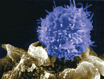 Le virus du Sida ne serait plus détecté chez un patient encore séropositif il y a trois ans. © vulgariz.com