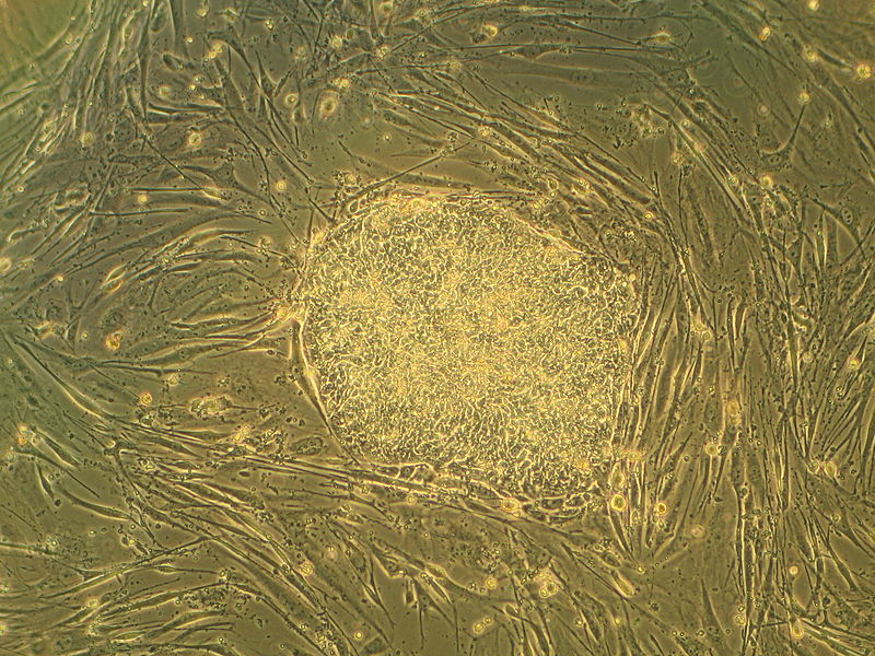Les cellules souches sont des cellules ayant la possibilité de se différencier en plusieurs tissus, voire tous pour les toutes premières cellules embryonnaires. Le cordon ombilical en dispose également, qu'on peut transformer en cellules de la peau. © Ryddragyn, Wikipédia, DP