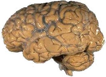 Cerveau humain.