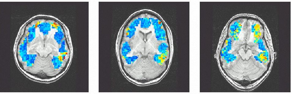 Imagerie par résonance magnétique d’un cerveau soumis à différents stimuli. Source : Carnegie Mellon University