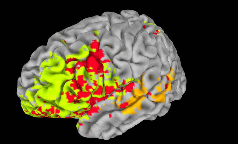 On a enfin une cartographie relativement précise de l'intelligence dans le cerveau. Sur cette image en fausses couleurs sont représentées les différentes zones impliquées. Dans le cortex temporal, sur le côté de l'encéphale, la couleur orange (indiquant l'intelligence générale) domine. Au niveau du cortex préfrontal, à l'avant, on voit beaucoup de vert (fonctions exécutives) et de rouge (régions communes). Les capacités intellectuelles se chevauchent donc et sont aussi interconnectées. © Aron Barbey