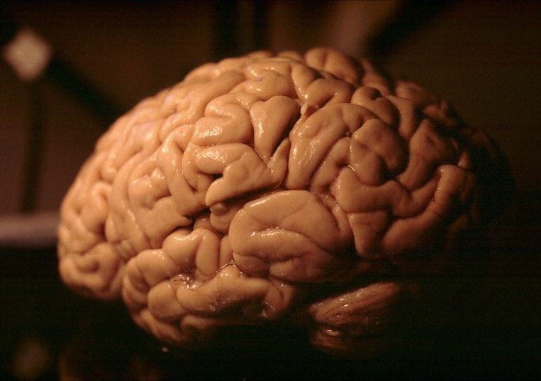 Au XIXe siècle, l'anatomiste Louis Pierre Gratiolet est l’un des premiers à décrire les circonvolutions cérébrales et à les nommer. © Heidi Cartwright/Wellcome Images/Flickr