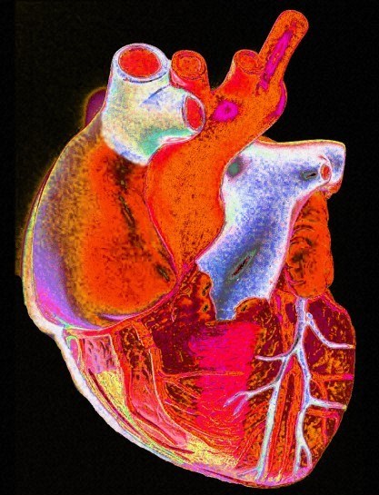 Le cœur et les vaisseaux sanguins&nbsp;peuvent&nbsp;pâtir d'une consommation forte d'ibuprofène ou de diclofénac sur une longue période. Il faut donc bien se renseigner sur l'utilisation de ces médicaments.&nbsp;© Gordon Museum, Wellcome Images, Flickr, cc by nc nd 2.0