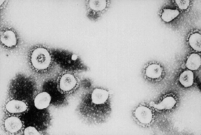 Lorsqu'ils sont pathogènes, les coronavirus, ou virus à couronne, s'attaquent surtout aux voies digestives ou respiratoires. Mais cela va du simple rhume jusqu'au Sras, mortel dans 9,5 % des cas. Son cousin s'avère pour le moment plus meurtrier encore : sur les 6 personnes infectées, deux sont mortes, soit un taux de mortalité de 33 %...&nbsp;© Erksine Palmer, CDC, DP