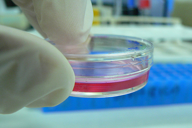 Les cellules souches pluripotentes induites humaines vont pouvoir être cultivées et étudiées plus efficacement. © kaibara87 / Flickr - Licence Creative Commons (by-nc-nd 2.0)