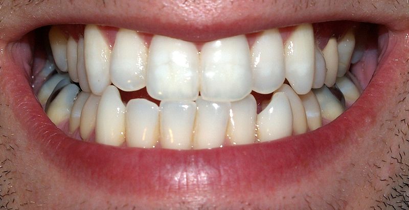 Les dents sont recouvertes d'une couche de fluor, beaucoup plus fine que ce que l'on pensait. © David Shankbone, Wikimedia, CC by-sa 3.0