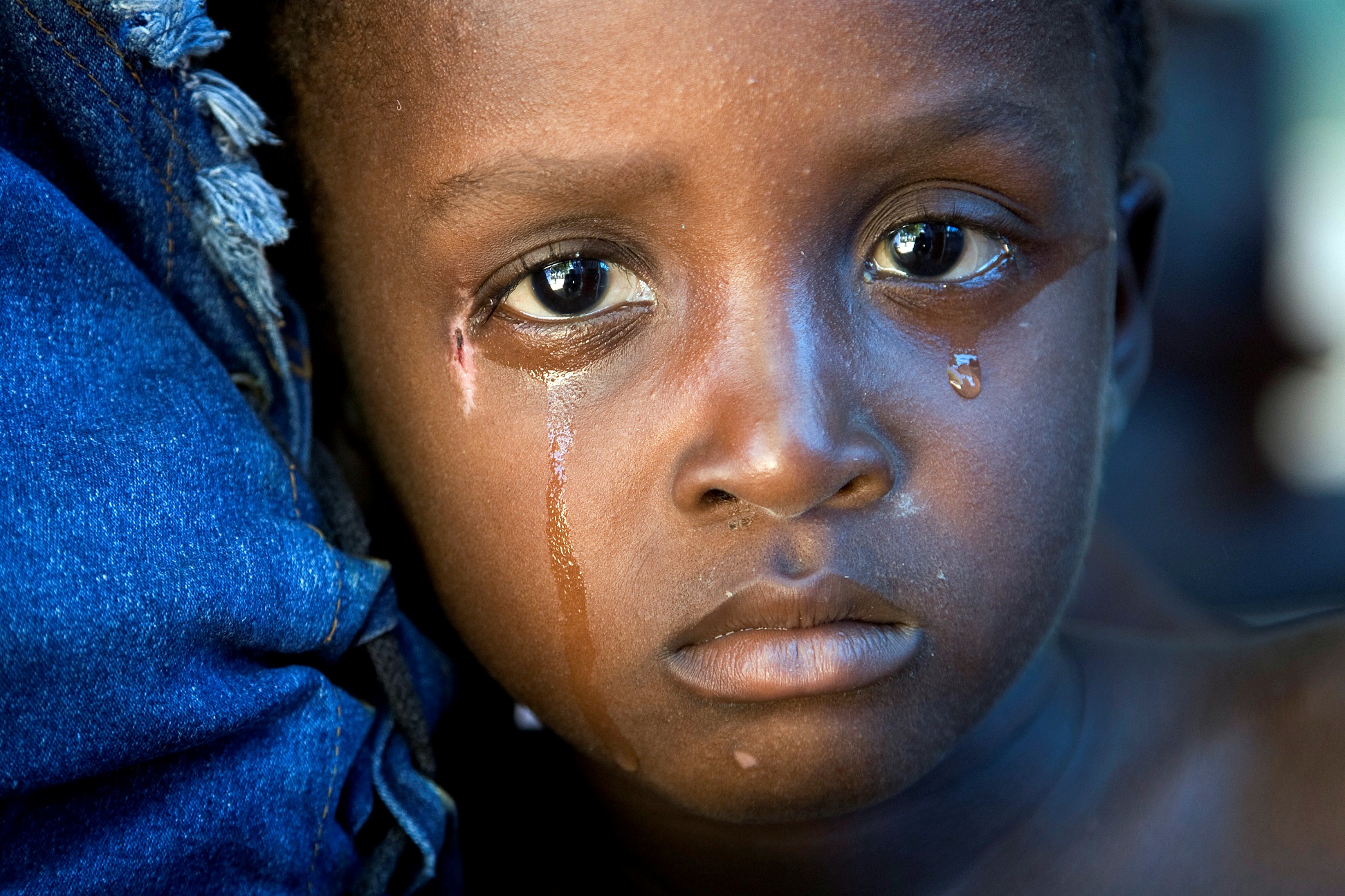 Ce petit haïtien est touché par l'épidémie de choléra qui a frappé son île à la suite du terrible séisme de janvier 2010. Cette maladie cause des diarrhées, à l'origine de très nombreux décès d'enfants.&nbsp;©&nbsp;United Nations Photo, Fotopédia, cc by nc nd 2.0