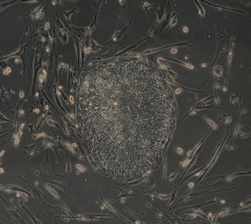 Ces cellules de peau humaine se sont transformées en cellules totipotentes après l’introduction de quatre gènes. © Junying Yu
