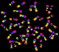 Crédits : INSERM ALPHA PICT 2000.Caryotype humain. Les chromosomes, par paire, possèdent des bandes de coloration caractéristiques.