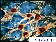 Image de neurones de l'encéphale qui compte de l'ordre de 100 milliards de neurones. On voit une sorte de réseau câblé constitué par les neurones et leurs prolongements, axones et dendrites. Crédits : INSERM