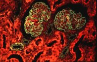 Crédits : INSERM 1990.Cortex de rein humain normal. Coloration du glomérule en vert, et en rouge cellules épithéliales des tubes contournés proximaux. Microscopie à fluorescence (immunofluorescence polychromatique).