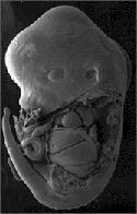 Embryon de souris à 13 jours de gestationCrédit:  http://www.med.unc.edu/embryo_images