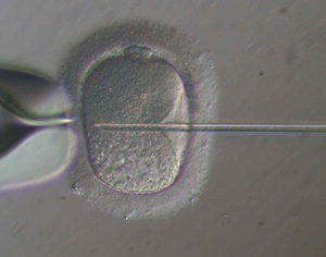 Fécondation in-vitro d'un ovocyte.crédit: CHU de Toulouse.