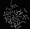 Chromosomes métaphasiquesCrédits : Laboratoire de Cytogénétique du CHR de METZ.