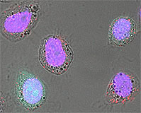 Capsides de Baculovirus  dans des cellules de cancer prostatique en culture